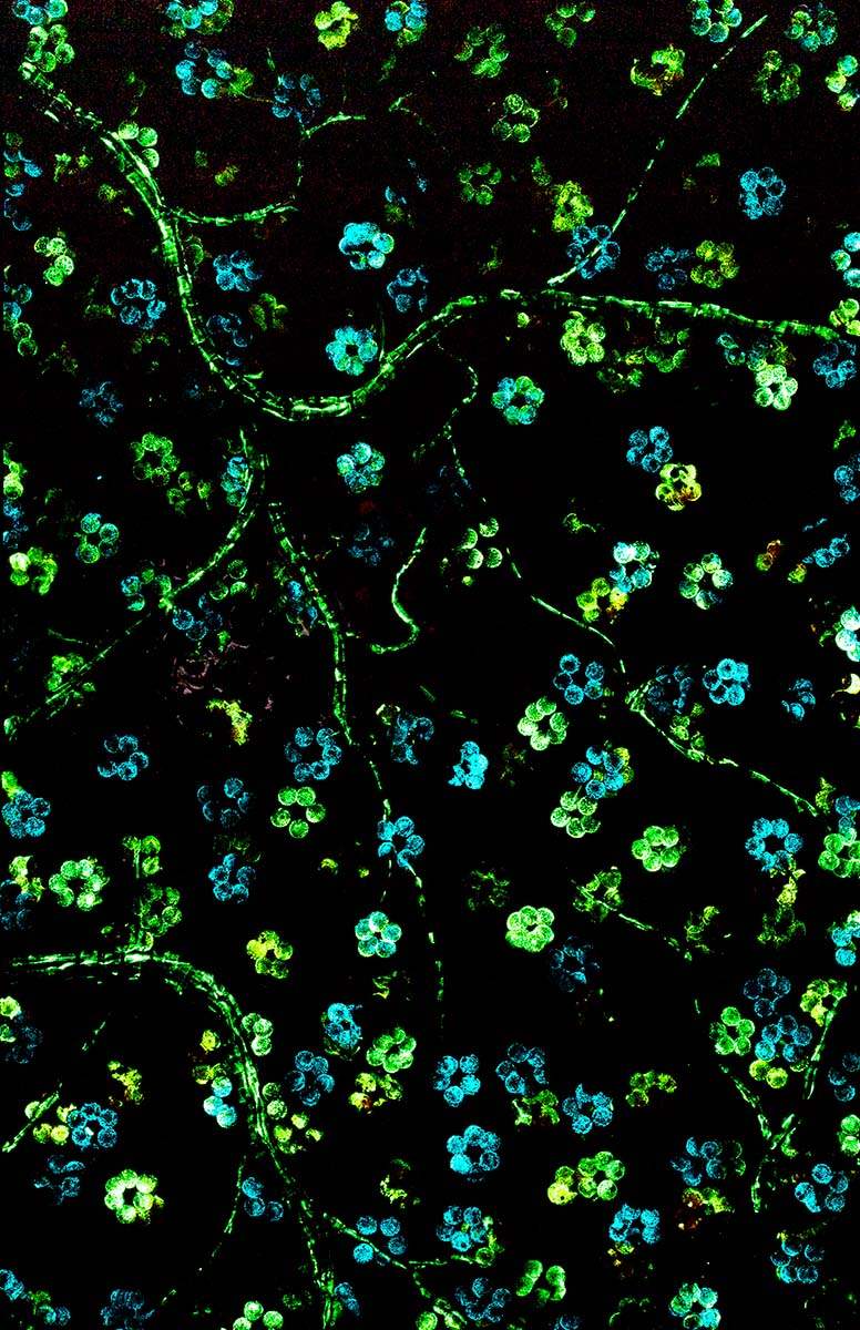 Ruby Blossom - Original - SOLD by artist Becky Smith - Wyecliffe Galleries