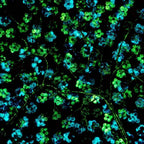 Sapphire Blossom - Diptych SET - Original - SOLD by artist Becky Smith - Wyecliffe Galleries