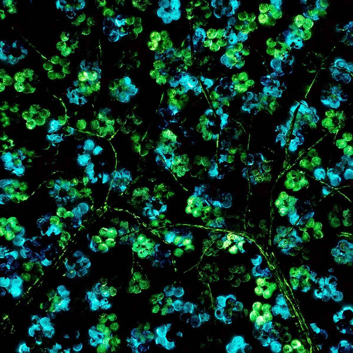 Sapphire Blossom - Diptych SET - Original - SOLD by artist Becky Smith - Wyecliffe Galleries