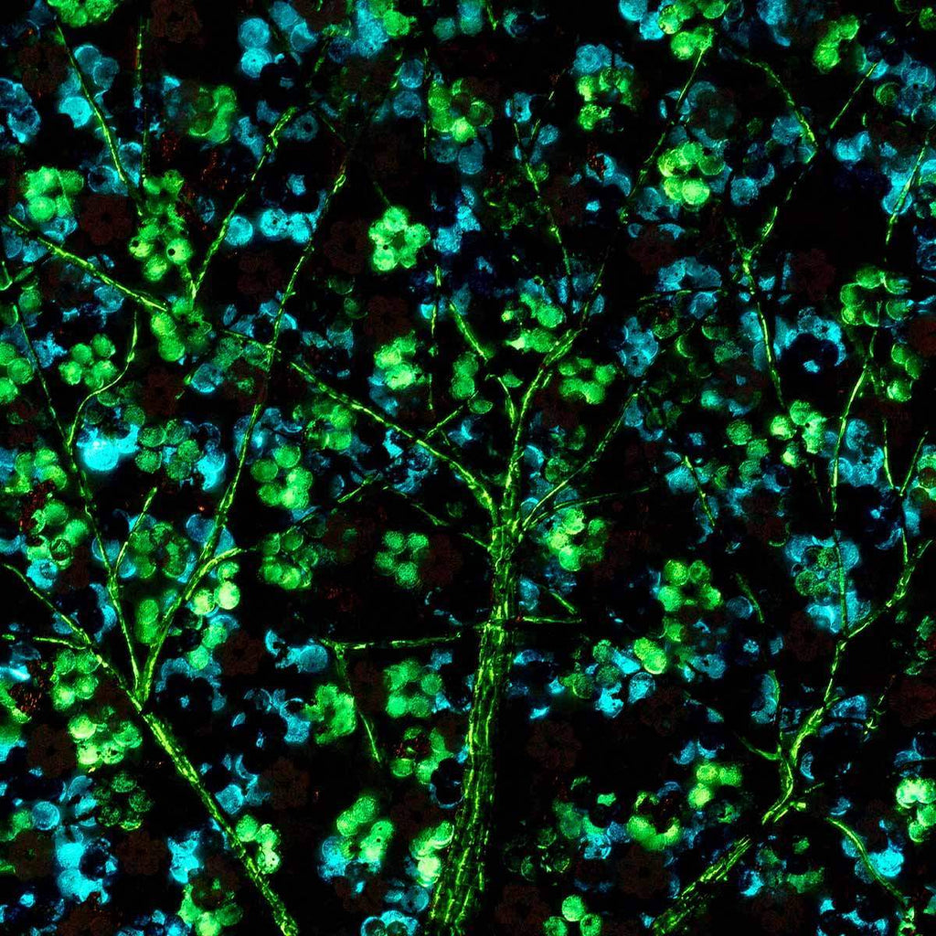 Sapphire Blossom - Diptych SET - Original - SOLD by artist Becky Smith - Wyecliffe Galleries