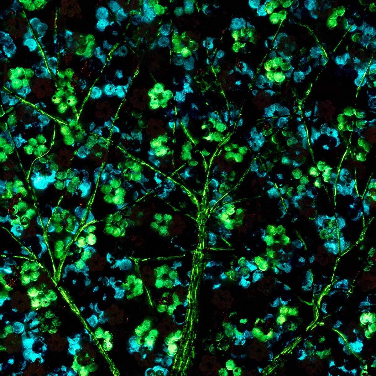 Sapphire Blossom - Diptych SET - Original - SOLD by artist Becky Smith - Wyecliffe Galleries