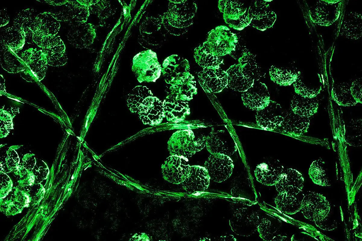 Winter in Bloom - Triptych - Original - SOLD by artist Becky Smith - Wyecliffe Galleries